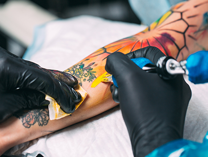 XĂM VÀ CÔNG NGHỆ XÓA XĂM